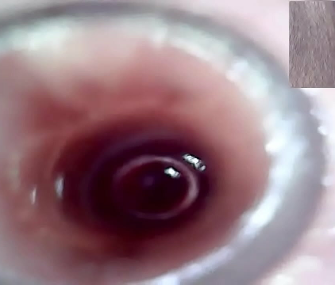 Japanese Lesbians Explore Each Other's Cervix With Pleasure Toys