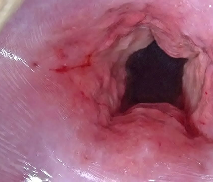Unleash Your Desires With This Insane Japanese Porn ~ Cervix Stretching And Uterus Dilation With Penetration!